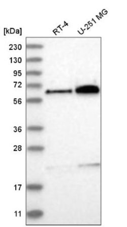 POC5 Antibody, Novus Biologicals POC5 Antibody; Unconjugated; 100 &mu;L:Antibodies,